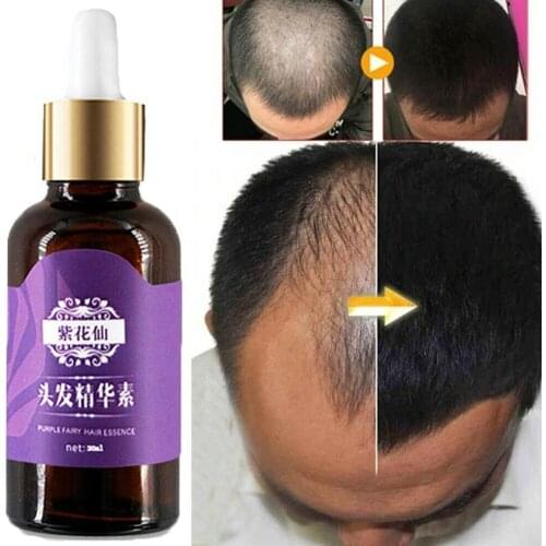 Hair growth essence hairline hair growth essence essence For men loss treatment women hair oil and N3B9