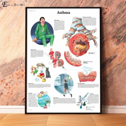 Anatomy Diseases Pathology Chart Canvas Prints Modern Painting Posters Wall Art Pictures For Living Room Decoration No Frame