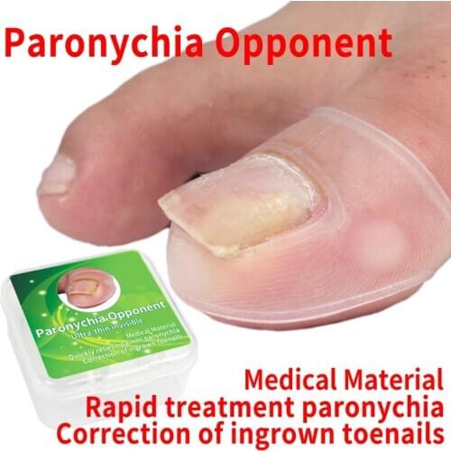 2pcs Ingrown Toe Nail Correction Sticker Patch Paronychia Invisible Nail Acronyx Orthotics Patch Elastic Straightening Brace