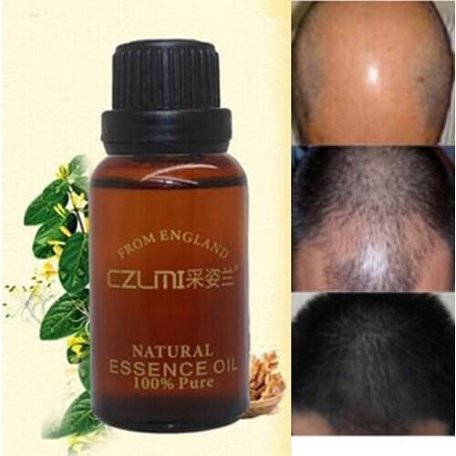 Boost Hair Growth Anti Bald Alopecia Hair Loss Remedies 100% Natural Herbs Anti Hair Loss Treatment