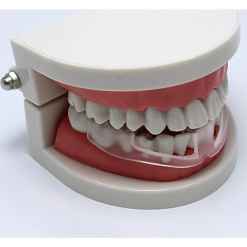 Mouth Guard Stop Bruxism Orthodontic Molar Set Teeth Braces Smile Adult Food Grade Anti-wear Brace Teeth Bracket Ortodoncia