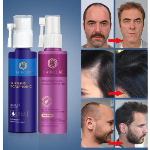 2Pcs Fast Hair Growth Essence Anti Hair Loss Treatment Dense Thick Nourish Hair Roots Regrowth Spray Hair Care Product Men Women