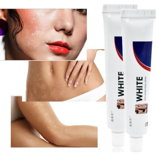 20g Chinese Medical White Spot Disease Cream Pigment Melanin Promoting Liniment Skin Vitiligo Leukoplakia Disease Treatment