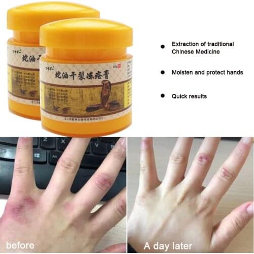 20G Winter Essential Snake Oil Anti-Cracking Anti-Chapping Dry For Frostbite Hand Itching Redness Moisturizer Repair Skin Ointme