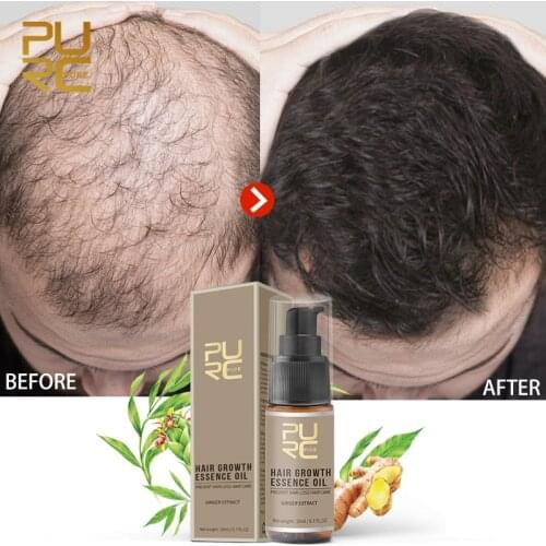 ELAIMEI Hair Loss Remedies