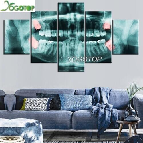 DIY Diamond Painting x-ray of Wisdom Teeth dental 5D Full Drill mosaic Diamant Embroidery Handcraft Kit Wall Art 5 Piece ML1050