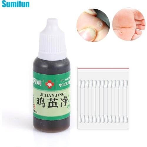1Pc Herbal Essence Oil Dark Spot Body Warts Tags 20Pcs Cotton Swabs Removal Against Big Moles Painless Liquid No Scars Skin Care