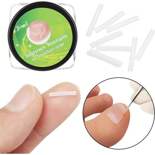 12Pcs Ingrown Toe Nail Correction Sticker Patch Paronychia Correction File Wire Corrector Foot Care Treatment Tool