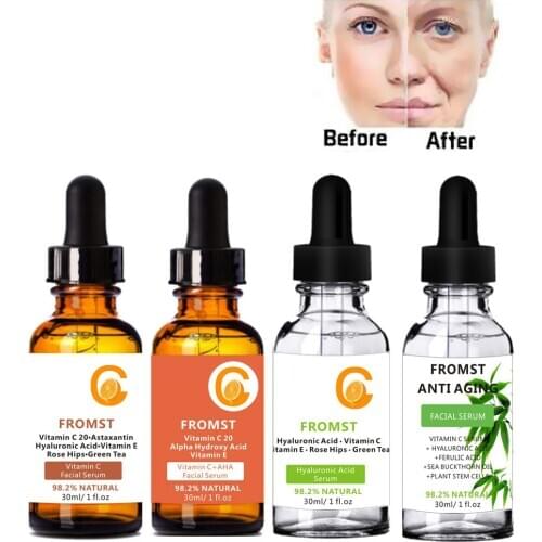 Anti-wrinkle Essence Moisturizes,Brightens Skin Tone,Improves Facial Yellowness,Anti Aging