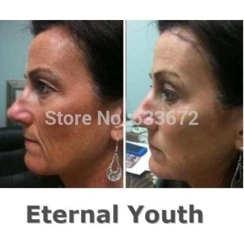 1KG Tight Anti-wrinkle Essence Fine Lines Lift Eye Cream Remove Adipose Bead Dark Circle Anti-Puffiness Anti-Aging