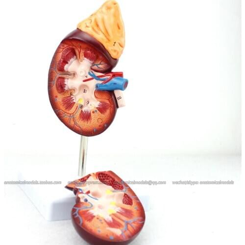 CMAM/12434 Kidney, 2-parts, Genitourinary Medical Teaching Anatomical Model