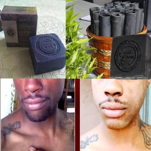 Natural Body Magic African Black Soap Whitening Soap Lightening Cream Fast Results Kojic Acid Soap Bleaching for Dark Skin
