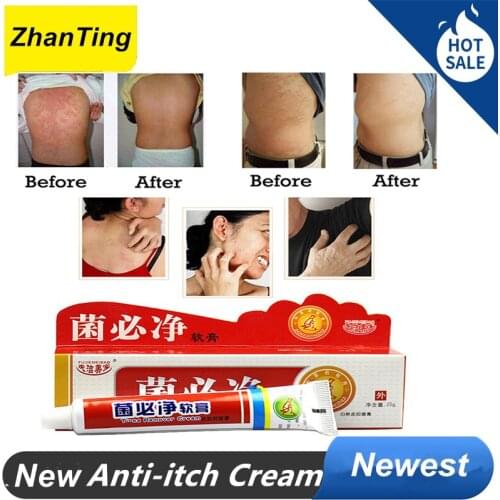 Skin Disease Dermatitis Men Women Skin Care Product Relieve Psoriasis Dermatitis Eczema Pruritus effect