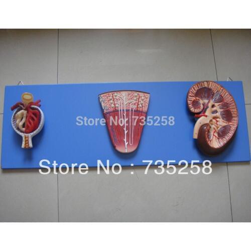 Kidney, Nephron and Glomerulus,Kidney Nephron, Glomerular Enlargement Model