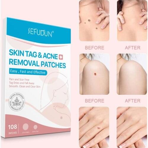 144/108PCS Skin Tag Remover Warts Remover Patch Skin Tag Genital Wart Remover Foot Corn Skin Plaster Acne Warts Unisex
