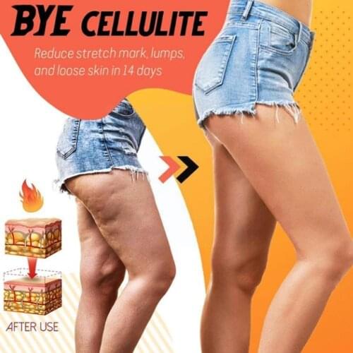 Herbal Fat Loss Spray Thin Leg Waist Burning Anti Cellulite Slimming Products Weight Lose S2D9