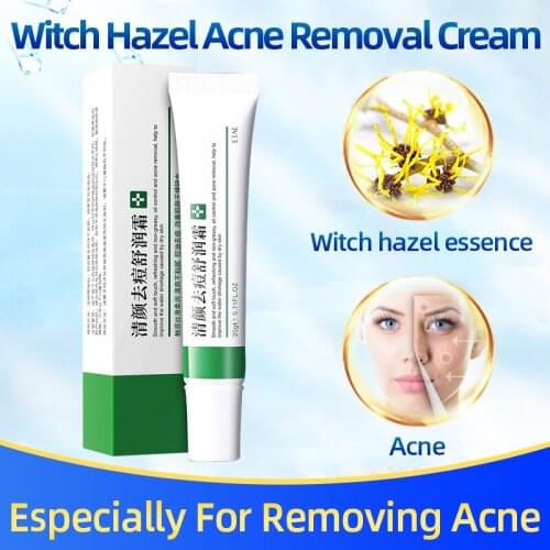 Clear Acne and Soothing Cream Treatment Anti Pimples Spot Acne Scars Blackhead Removal Whitening Skin Care
