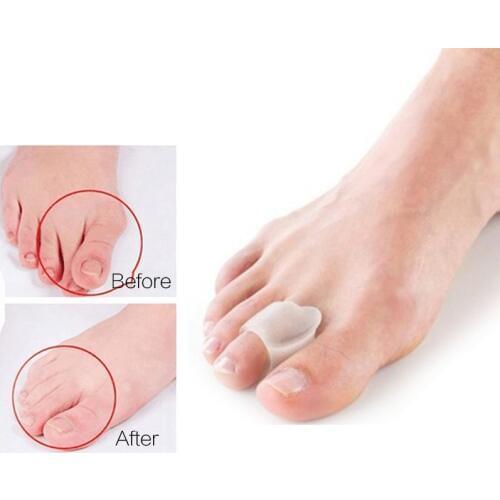 2Pcs=1Pair Orthopedic Toe Separators Valgus Pro Corrector Overlapping Straightener Foot Massage Pedicure Device Bunion Protector