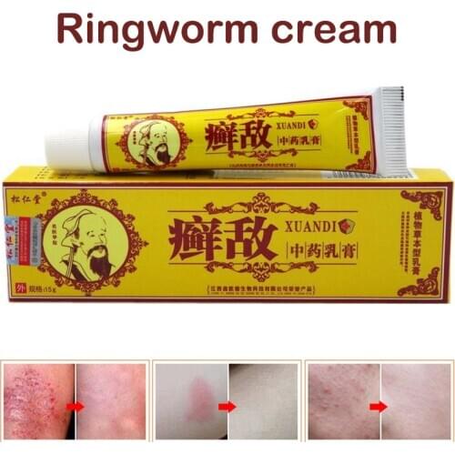 2021 Psoriasis Eczema Cream Antibacterial Itchy Cream for Body Skin SSwell
