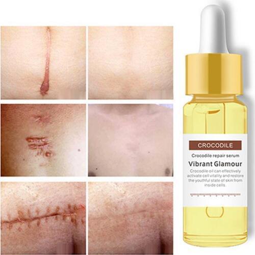 Crocodile Repair Scar Face Serum Removal Acne Scar Firming Whitening Spots Acne Treatment Stretch Marks Essence Skin Care 15ml
