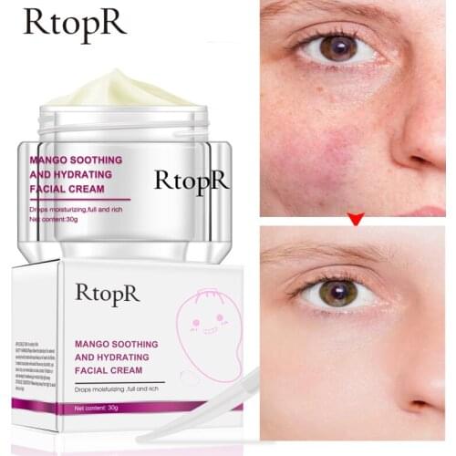 RtopR Mango Moisturizing Facial Cream Anti-Wrinkle Anti Aging Whitening Liquid Tights Nourishing Shrink Pores Hyaluronic Acid