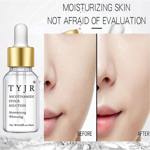 Nicotinamide Source Refined Skin for Rough Skin Repair Moisturizing Whitening Reduce Skin Blemishes Base Oil control Ordinary