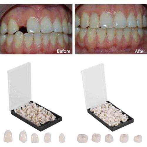 50Pcs/Box Dental Crowns Resin Porcelain Materials Temporary Teeth Crown Realistic Oral Care Teeth Whitening Anterior Molar Crown
