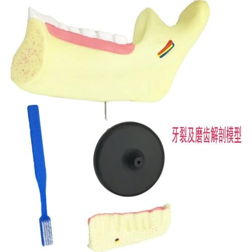 Children Dentition and Molar Anatomical Model Right Lower Incisor Permanent Incisor Permanent Molar Scale-up Anatomical Model