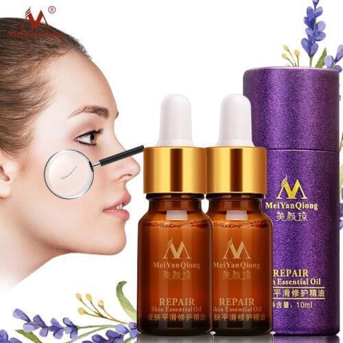 2pcs/lot Repair Skin Essential Oil Scar Ance Treatment Care Anti Acne Anti Scar, Skin Whitening Face Massage Body Essential Oil
