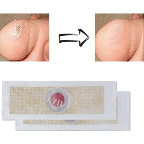 42Pcs Foot Corn Removal Plaster Cure Callus Health Pad Patches Relieving Blisters Painless Warts Thorn Treatment Tool