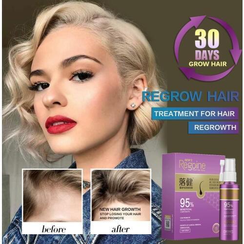 Hair Growth Essence Oil Spray Fast Hair Growth Natural Anti Hair Loss Treatment Hair Solution Hair Care Products Hair Tonic