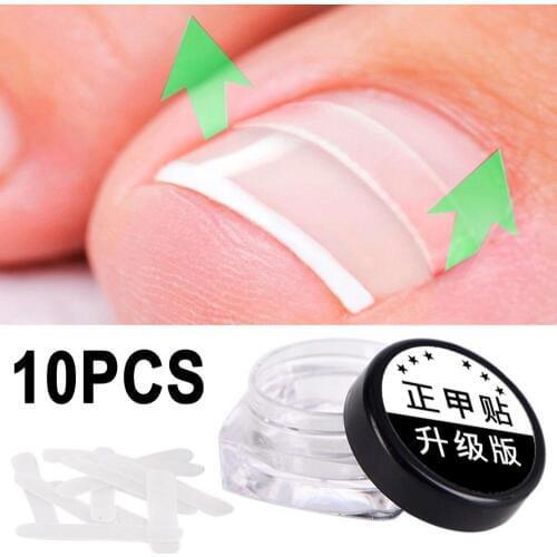 10pcs Ingrown Toenail Correction Tool Ingrown Toe Nail Treatment Elastic Patch Sticker Straightening Clip Brace Pedicure Tool