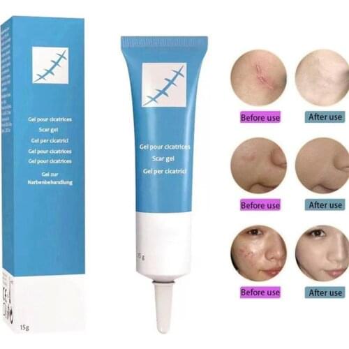 15g Scar Removal Cream Acne Scar Stretch Marks Removal Skin Repair Cream