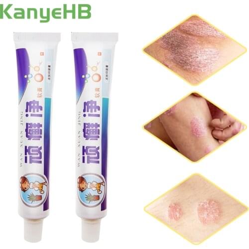 2pcs Treatment Psoriasis Cream Bacteriostasis Eczema Dermatitis Anti-inflammatory Pruritus Antipruritic Eczematoid Ointment