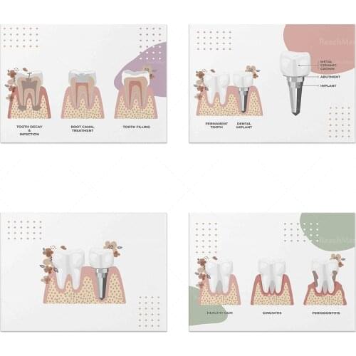 Tooth anatomy art, dentist gift, dental implant label, dentist office decoration, dental hygienist, dental assistant, dental art