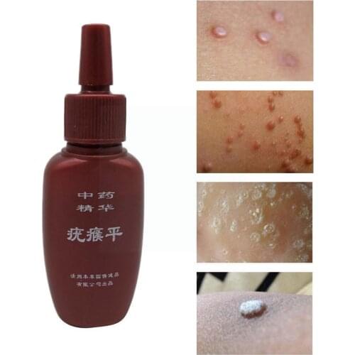 Effective Skin Tag Remover Gel Removal Mole & Papillomas Corn Q3W7