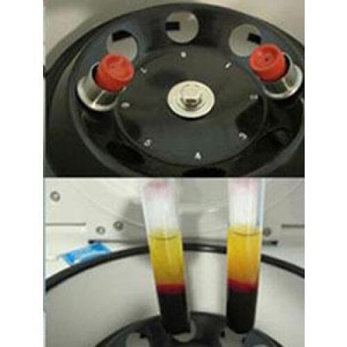 10ml PRF tube Platelet rich Fibrin, 10ml Blood PRF tube for detistry, Maxillofacial surgery, orthopedics, plastic surgery