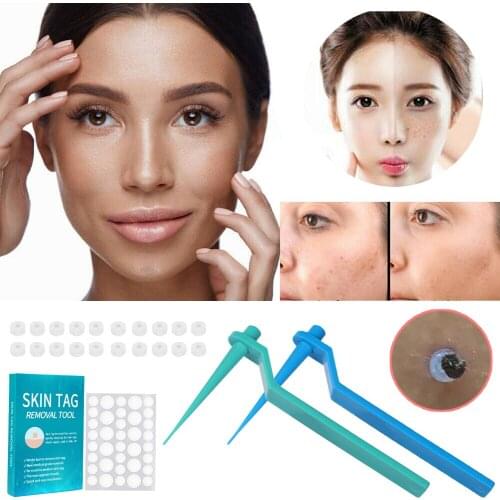 Skin Tag Removal Kit Home Use Mole Wart Remover Equipment Micro Skin Tag Treatment Tool Easy To Clean Skin Care Tool Dropship