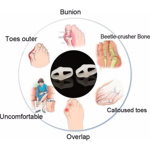 55Pairs Foot Separators Adjustable Toe Stretchers Straighteners Alignment Bunion Gel Orthotics Hammer Care Tools For Pedicure