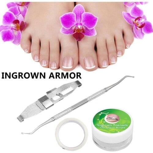 1 Set Ingrown Toe Nail Straightening Clip Wire Fixer Toenail Patch Patches Elastic Correction Curved Pedicure Tool Toenail Z0K4
