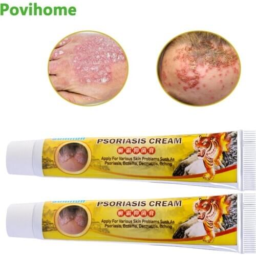 2Pcs 20g Sumifun Tiger Balm Antibacterial Ointment Skin Care Treatment Psoriasis Dermatitis Eczema Anti-itching Cream