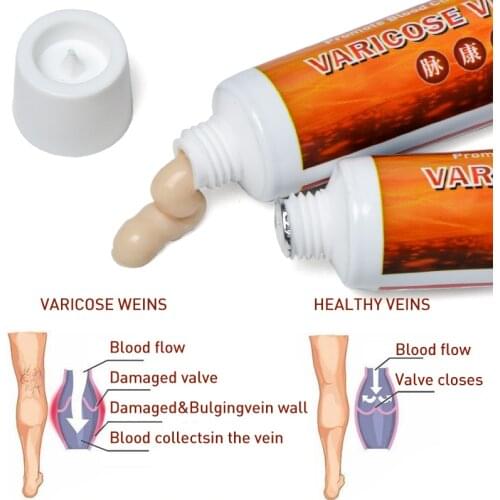 Sumifun Varicose Veins Treatment Cream 100% Original Vasculitis Phlebitis Spider Pain Relief Ointment Medical Plaster