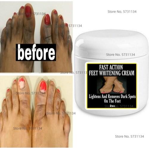 Fast Feet lightening cream , Spotless feet, Fast action , Fast results