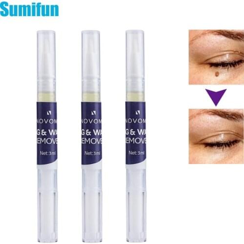 1pcs Hot Skin Tag Remover Cream Against Mole & Genital Wart fast Remover Anti Foot Corn Removal Papillomas Rapidly removes mole