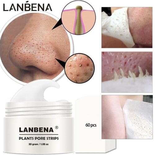 LANBENA Point Noir Blackhead Remover Nose Mask Pore Strip Black Mask Peeling Acne Treatment Black Deep Cleansing Skin Care korea