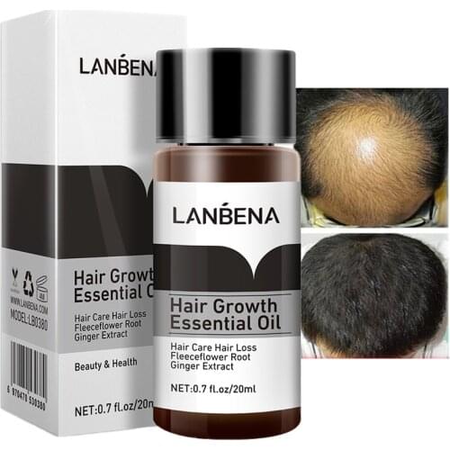 Hair Growth Serum Anti-hair Loss Scalp Treatment Liquid Thick Fleeceflower Root Ginseng Extract Ginger Healthy Hair Care 20ml