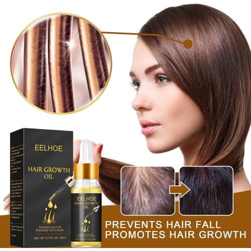 YYKYHL Hair Growth Oils
