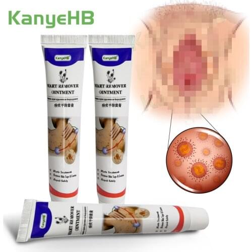 3pcs Vulva Condyloma Acuminatum Wart Remover Cream Genital Acuminatum Herpes Skin Tag Remover Antibacterial Treatment Ointment