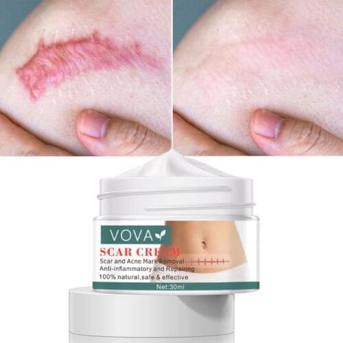 Acne Scar Removal Cream Pimples Stretch Marks Face Gel Remove Acne Smoothing Whitening Moisturizing Body Skin Care