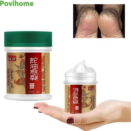 1/3 pcs Dead Skin Remover Snake Oil Repair Skin Care Product Anti-Drying Crack Cream Banana Oil Repair Skin Care Product